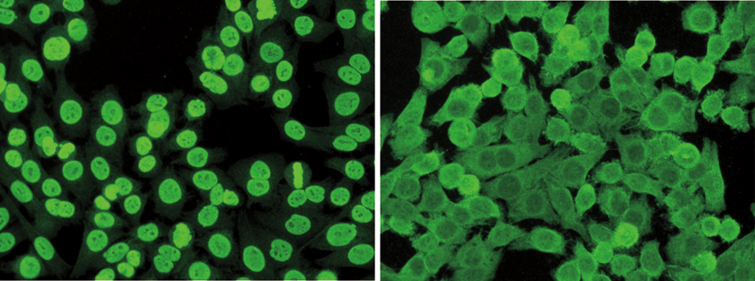 Blood cells from mice with lupus (left) have DNA-killing autoantibodies (green) in their nuclei. Blood from mice with lupus that lack Nox2 (right) glow mainly from their exteriors instead. The NETs and Nox2 actually protected the mice from the disease.