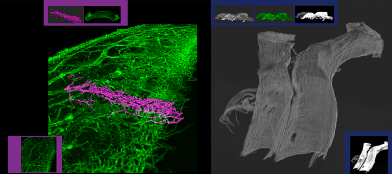 LEFT: By using VR to explore the white of an eye, Nils Loewen saw outflow tracts that he couldn’t before. It turns out that the collapse of these tracts (highlighted in purple) leads to glaucoma. RIGHT: These are human cerebral vessels. Engineer Anne Robertson says she never would have been able to see the artery’s fibers in this detail and over such a “vast” area without the CBI’s novel techniques.