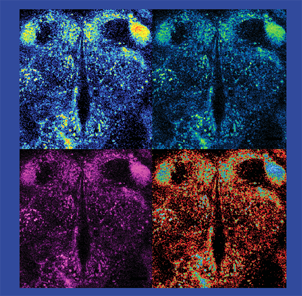 Using fluorescent tools, Freyberg found that pH level may play an important role in how neurons talk to one another. Here, four different color filters illuminate dopamine in the adult fly brain. 