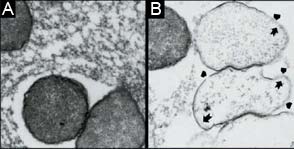 The bacterium S. marcescens (A) treated with eCAPS (B).