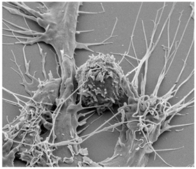 Here's a T cell with dendritic cells (long, treelike shapes) attached, in the process of transinfection. Pitt researchers are exploring what happens when dendritic cells have less cholesterol. They think that might protect against transinfection.