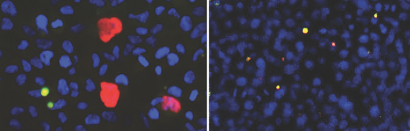 The Chang-Moore team was the first to observe Merkel cell virus replicating in a lab. Here, their mutant virus (left, in red and yellow) infects a new crop of cells (blue, on the right). 