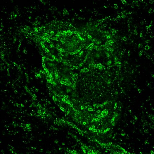 When ordinary microscopes visualize mitochondria, they show up as blurred blobs. The new STED (stimulated emission depletion) microscope just installed by Simon Watkins offers super-resolution microscopy. In this image, a slice of a rat’s substantia nigra—part of the brain affected in Parkinson’s—is shown. The mitochondrial membrane here is stained fluorescent green, showcasing many tubular mitochondria that fill just one dopamine-producing neuron. This extraordinary level of detail allows Ed Burton and his team to gain far greater insight into how mitochondria function in healthy and damaged neurons.