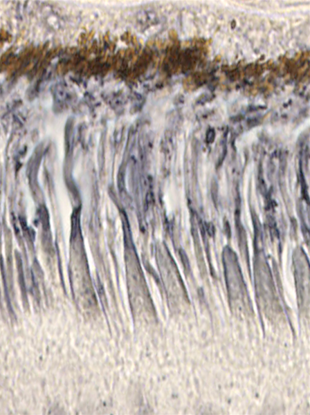 In retinitis pigmentosa, rod cells die because of a genetic mutation; Sahel’s team discovered why cone cells eventually die, too. Rods release a protein, RdCVF, that cones need to absorb energy. Here, RdCVF’s receptors (gray) dot both the edges of the conical cells inside the brown epithelial cell layer.