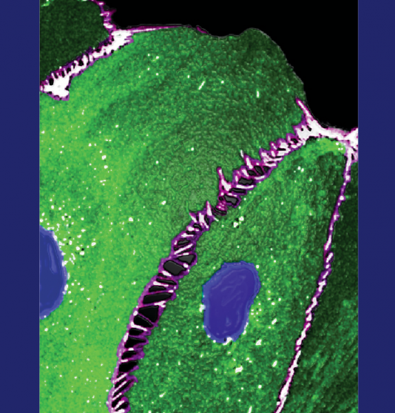In cases of infection, cells along the linings of blood vessels (green) separate, allowing immune cells to pass through the cracks (black) and rush to the aid of damaged tissue. MALT1 can set this process in motion.
