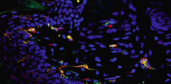 A Pitt team demonstrated that pain-sensing nerves help fight skin infections and prevent their spread, suggesting a new type of immunity. The above image shows dermal and epidermal expression of ion channels (green) that allow pain to reach the brain from the skin. Here we can also see antibody expression shown in nerve fibers (red) and cell nuclei (blue). 
