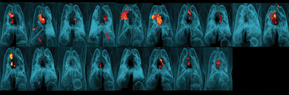 Researchers from NIAID and Pitt showed that just by changing the method of delivering the TB vaccine, they could ward off inflammation (red and yellow) greatly in a monkey model. The top row shows typical vaccination delivery—through the skin. The bottom row shows delivery through intravenous injection. 