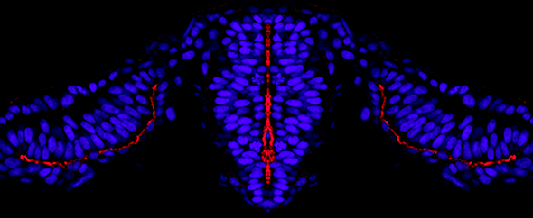 Xiangyun Wei’s team lays out how asymmetry leads to symmetry in zebra fish. Does the blue and red image look a little wonky? In the case of mobile, fast-dividing cells—like those in a zebra fish’s early embryonic neural system—capturing a perfectly symmetrical image is a near statistical impossibility. 