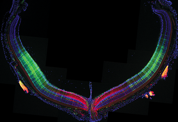 This cross-section of the retina shows that injecting AAV9 vectors carrying two different transgenes (one expressed in red, the other green) at different times works. What’s the clinical relevance? Sequential injections may result in better gene therapy coverage in utero. 