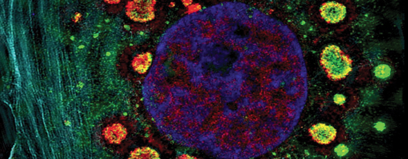 A human cell (components in blue and cyan) infected with reovirus (green and red).