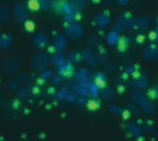 Stubborn, stealthy, and dangerous bacteria biofilms (green) grow atop airway epithelial cells from a cystic fibrosis patient.