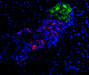 Immune cells invade a rodent islet (cell nuclei in blue) in a diabetes-prone mouse. In type 1 diabetes, the islet’s insulinproducing ß cells (green) come under attack by immune cells (CD4+ T cells in red) when certain aspects of the immune system’s “brakes” are lacking. Vignali’s lab has discovered several pathways that contribute to this process.