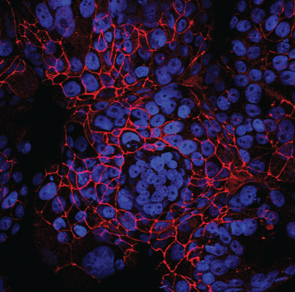 Placental cells are notoriously tough to culture—they need to move. Here, the cells (nuclei in blue) thrive in a churning microgravity bioreactor. Certain cell types fuse into conglomerates called syncytiotrophoblasts (red), which defend a fetus against infection.